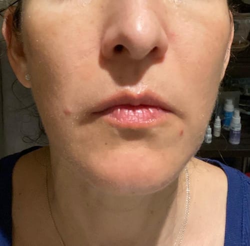 Customer photo review of Red Centellaca Mask