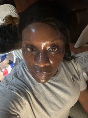 Customer photo review of No More Pore Pads