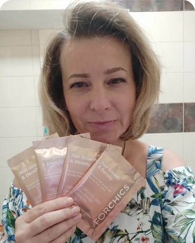 Customer photo review of ForChics Hair Growth Density