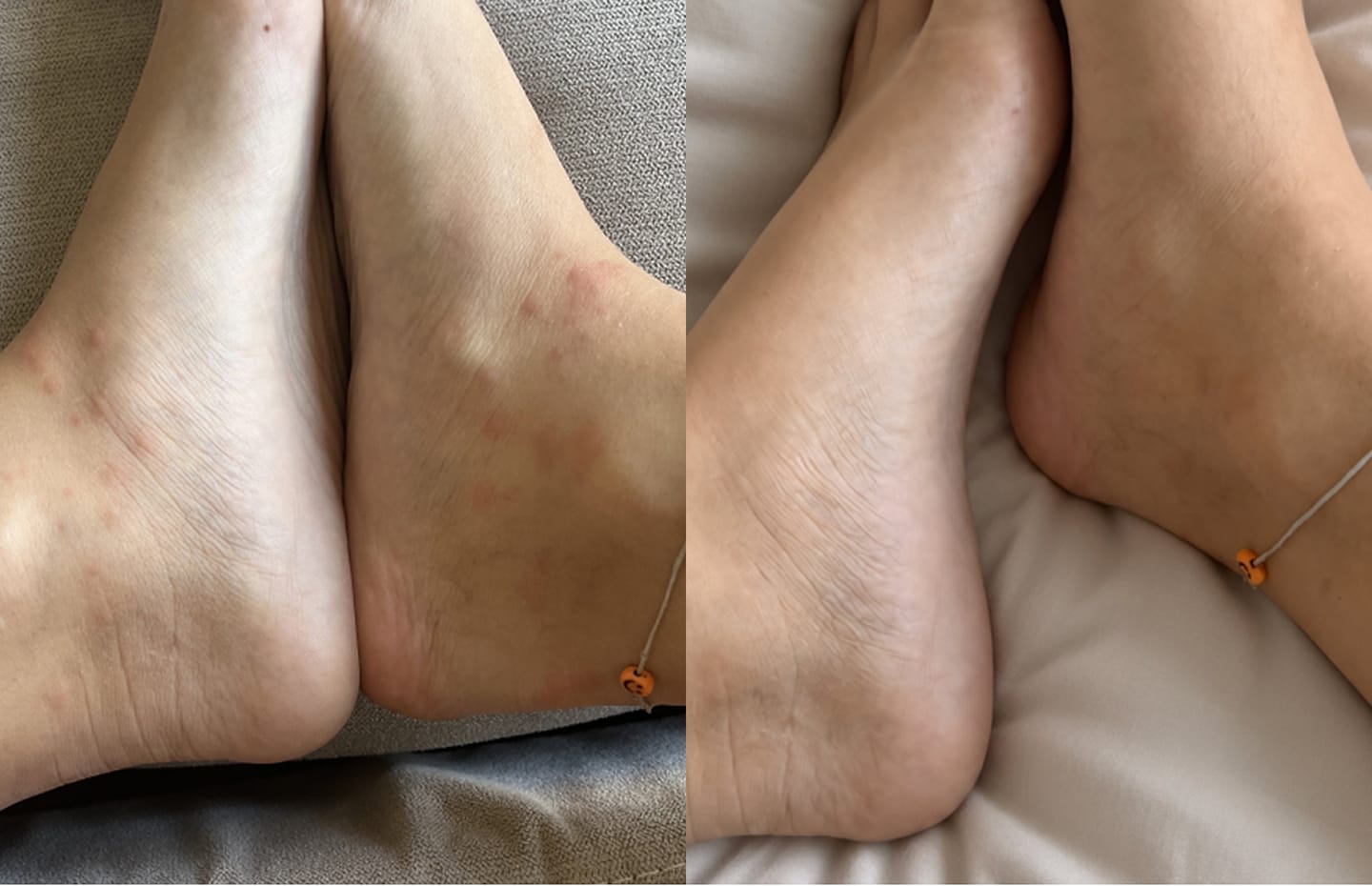 Customer photo review of Ultra Nourishing Arctic Botanicals Body Balm