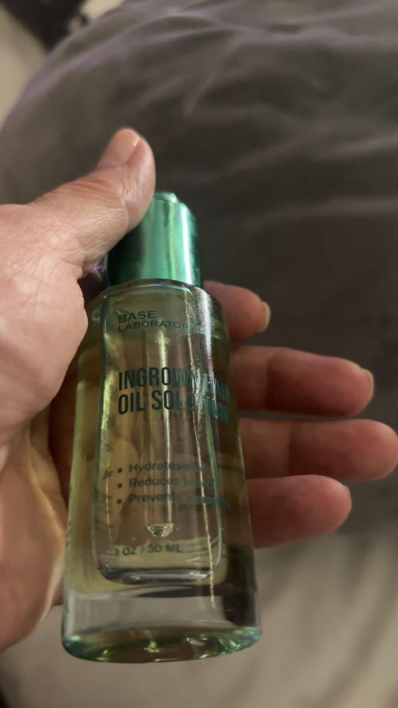 Customer photo review of Razor Bump Rescue Duo