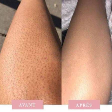 Customer photo review of YVELYS Soin Lissant Peau de Fraise
