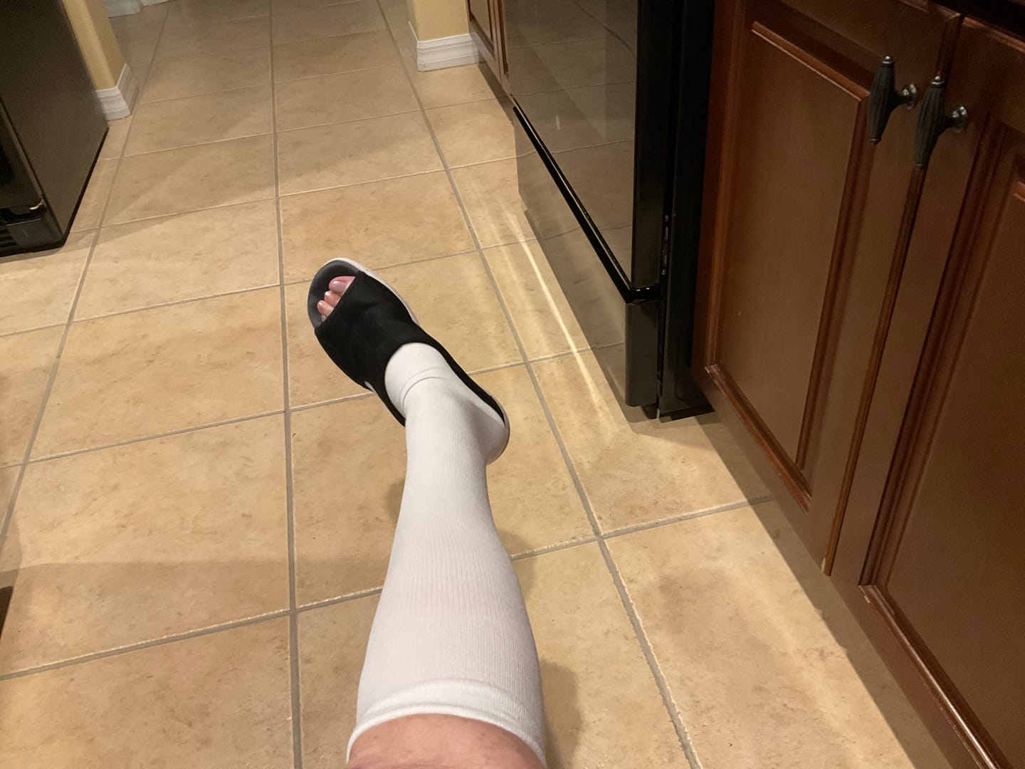 Customer photo review of EverSock™ Bamboo Open Toe Compression Socks