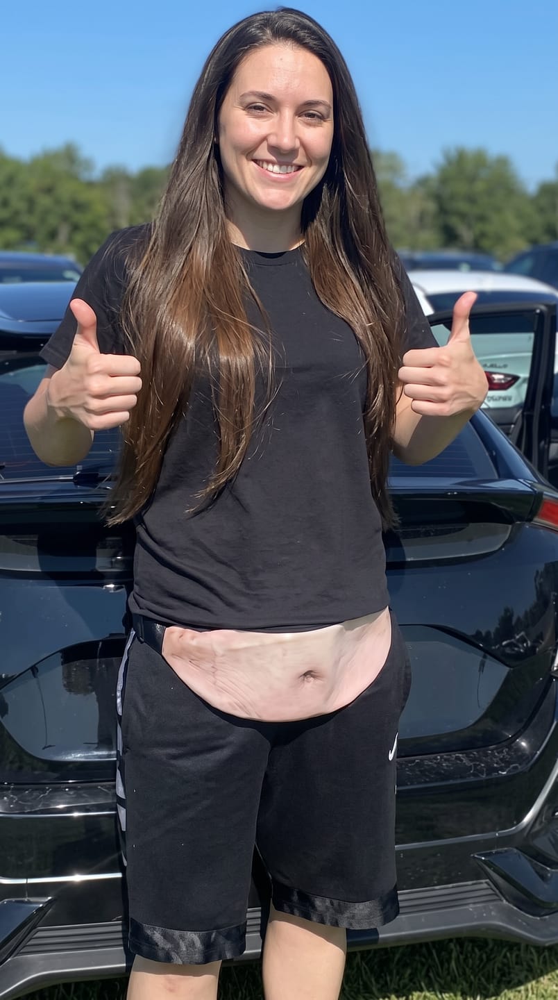 Customer photo review of BellyGap™ — Riñonera con estampado de barriga