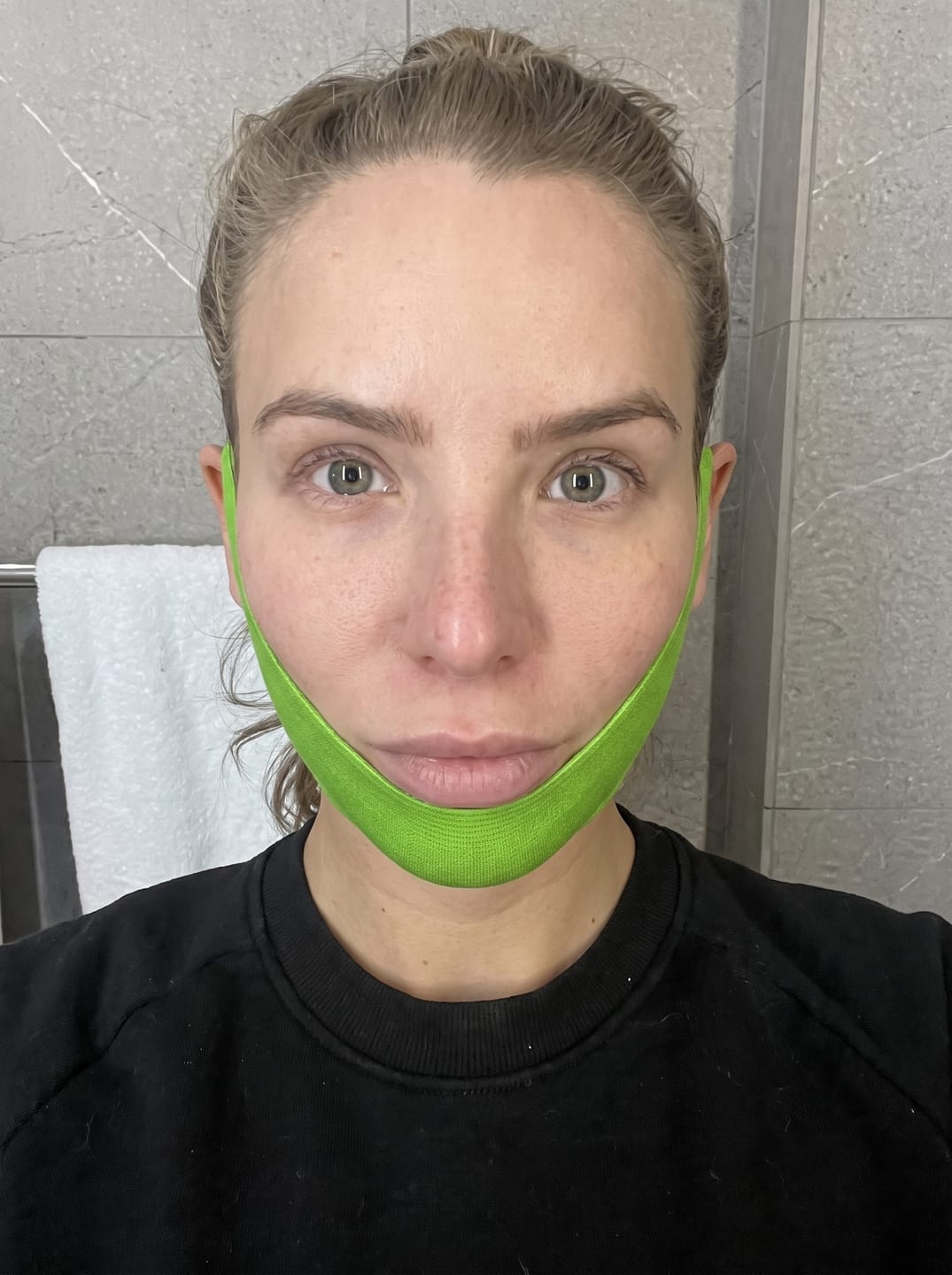Customer photo review of Cooling Jawline Sculpt V-lifting Band