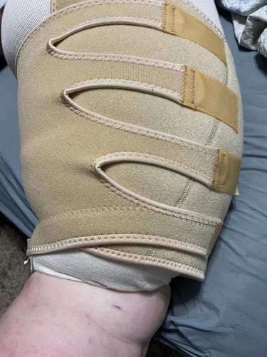 Customer photo review of Duftstofffreie, nicht fettende Anti-Juckreiz-Lotion mit Ceramid NP für trockene, gerötete und empfindliche Haut