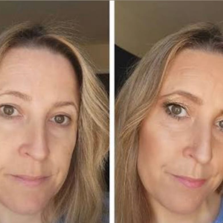 Customer photo review of MIRACLE - La tua pelle, nella sua versione migliore.