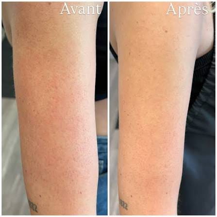 Customer photo review of YVELYS Soin Lissant Peau de Fraise