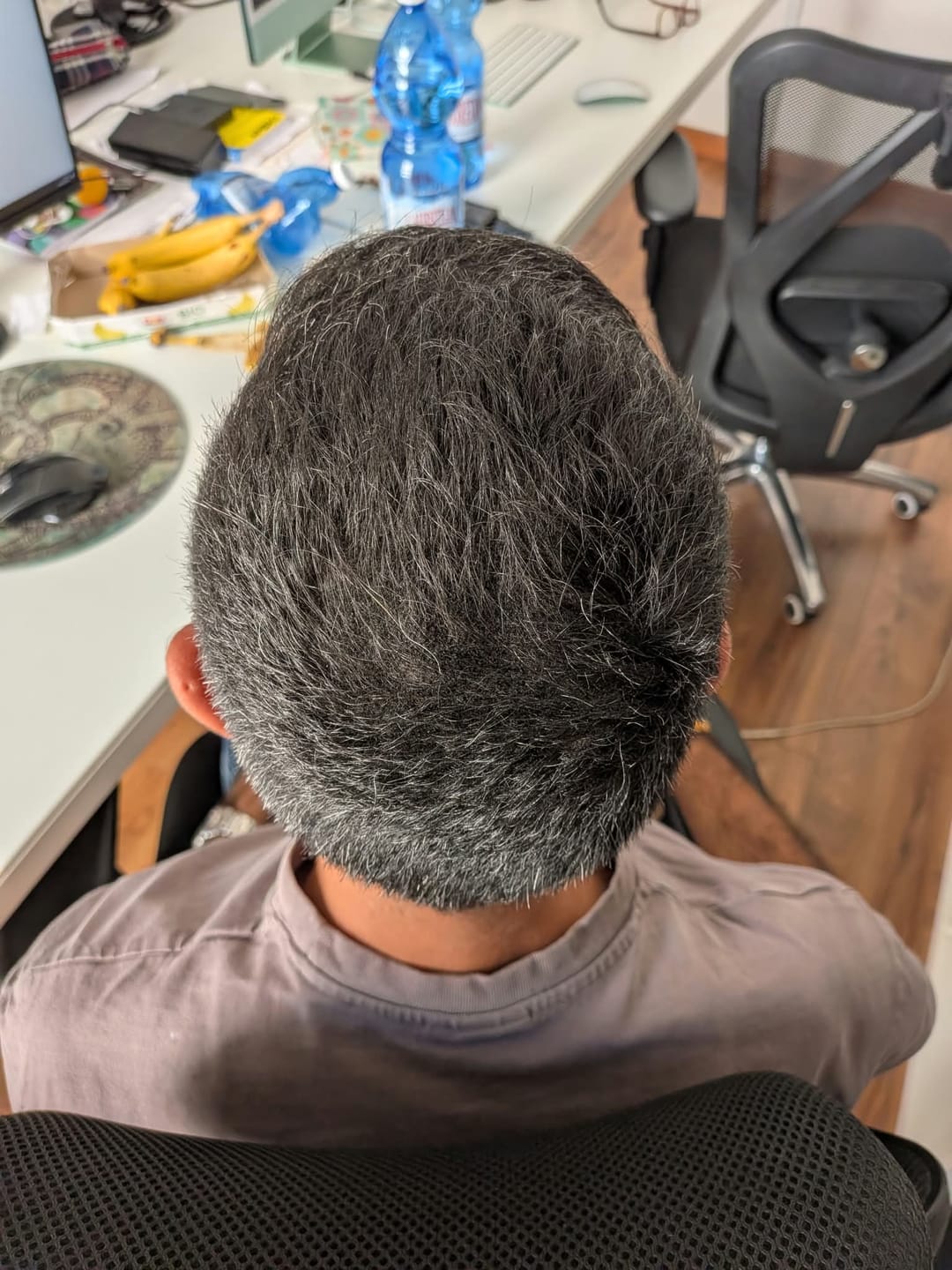 Customer photo review of Fibre copri Calvizie da 7gr | Grigio | 15 Giorni Applicazione