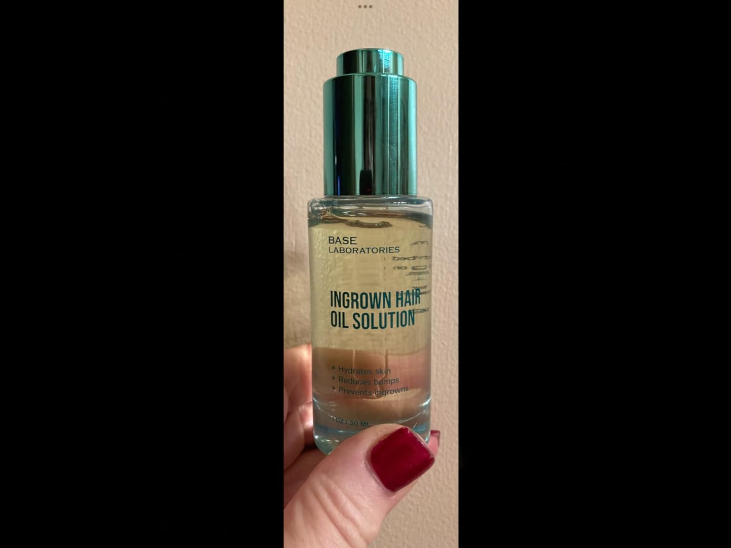Customer photo review of Ingrown Hair Complete Extraction Kit