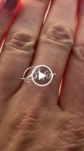 Customer photo review of Duftstofffreie, nicht fettende Anti-Juckreiz-Lotion mit Ceramid NP für trockene, gerötete und empfindliche Haut