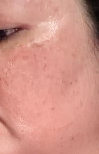 Customer photo review of PDRN Pink Collagen Gel Toner Pad