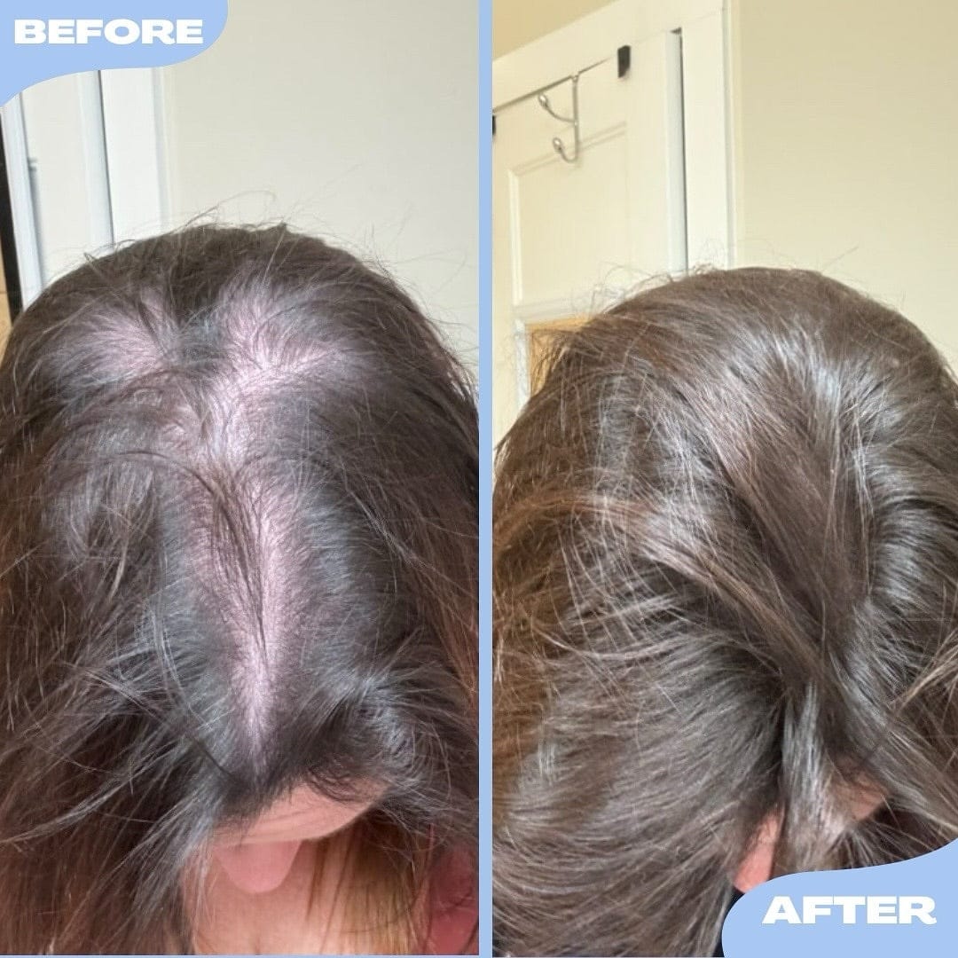 Customer photo review of Nolya Red Light Therapy Hair Brush