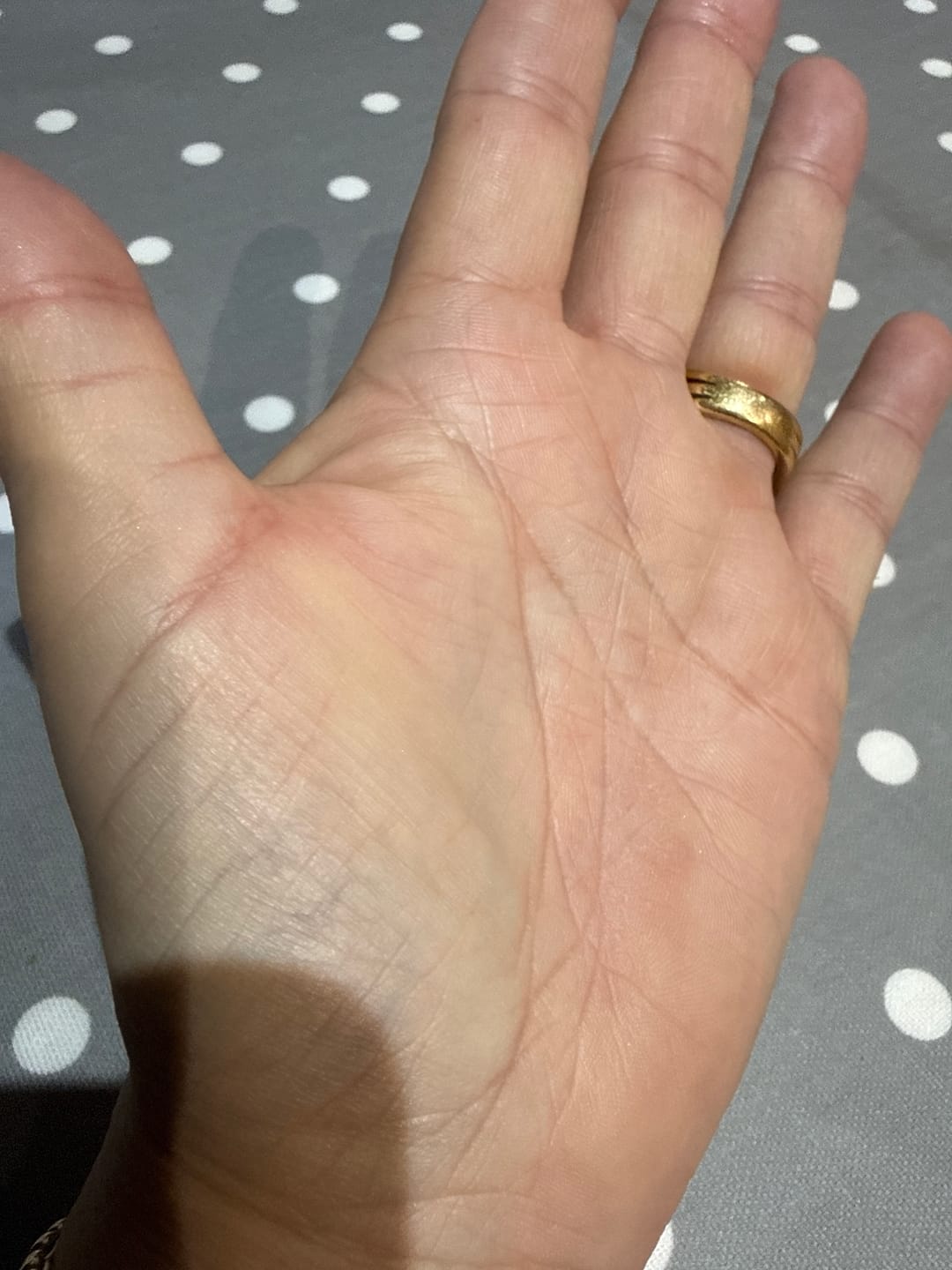 Customer photo review of Bioskin Zeoderm Skin Repair Moisturiser