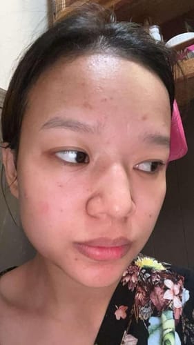 Customer photo review of Zero Pore Serum