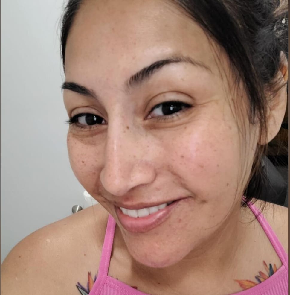 Customer photo review of Barra de Cúrcuma - Aclara Manchas y Devuelve la Luminosidad