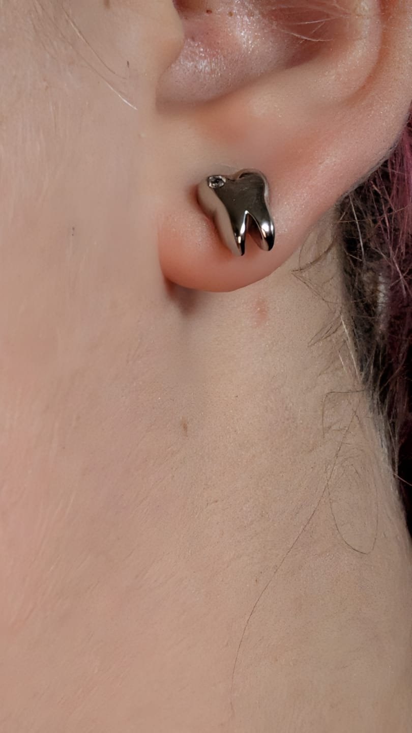 Customer photo review of Cavity Studs