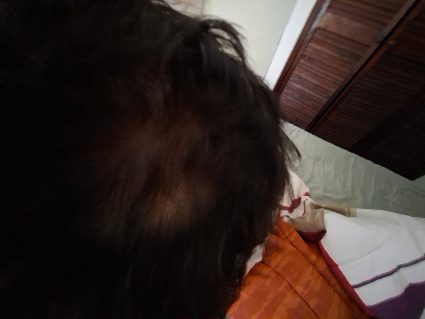 Customer photo review of Minoxidil 5 mg con 90 tabletas para 3 meses de tratamiento