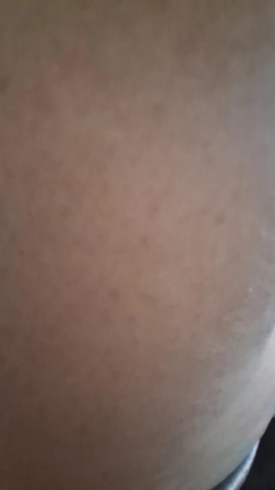 Customer photo review of ORTHEVIA OrthoVital™ Pro 3-in-1 Back Massager