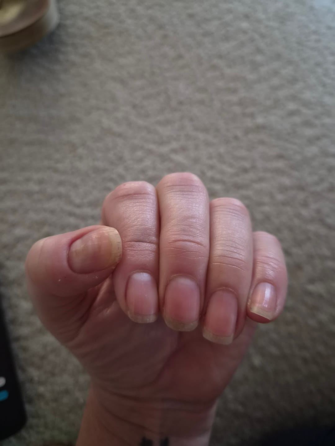 Customer photo review of Mavala Scientifique K+ Nail Hardener - 5ml