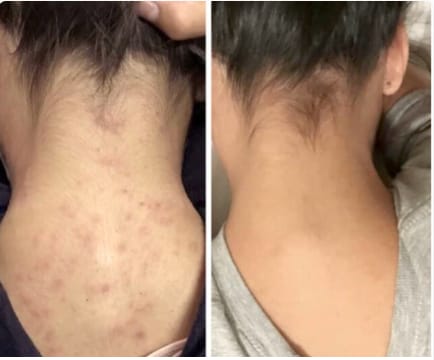 Customer photo review of Barra de Cúrcuma - Aclara Manchas y Devuelve la Luminosidad