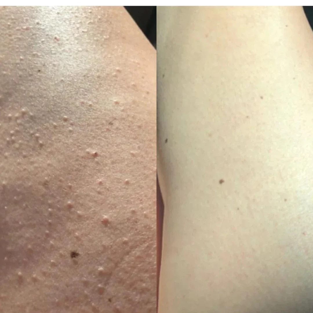 Customer photo review of Rasoio ROSALOVA