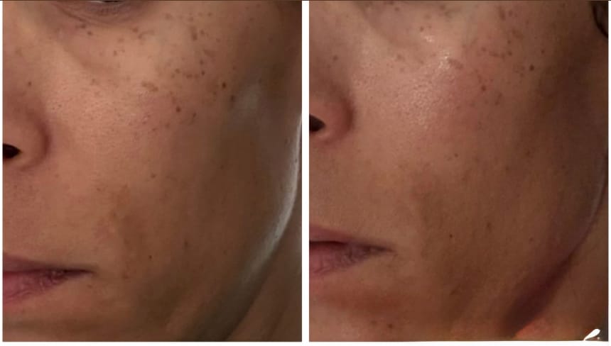 Customer photo review of Barra de Cúrcuma - Aclara Manchas y Devuelve la Luminosidad