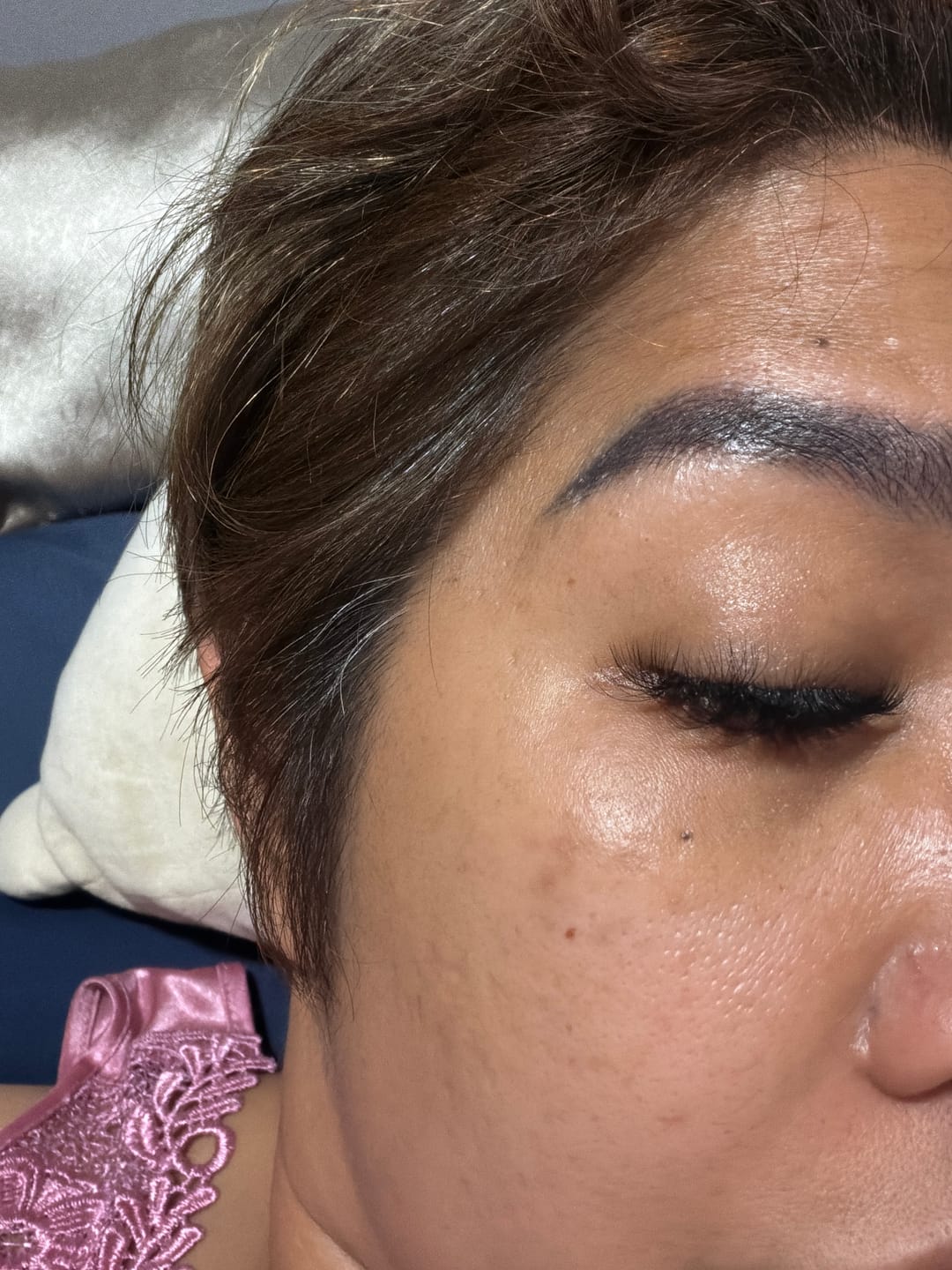 Customer photo review of Ventamin Light Up: Doctor-Formulated Brightening Formula for Melasma, Acne scars & Hyperpigmentation
