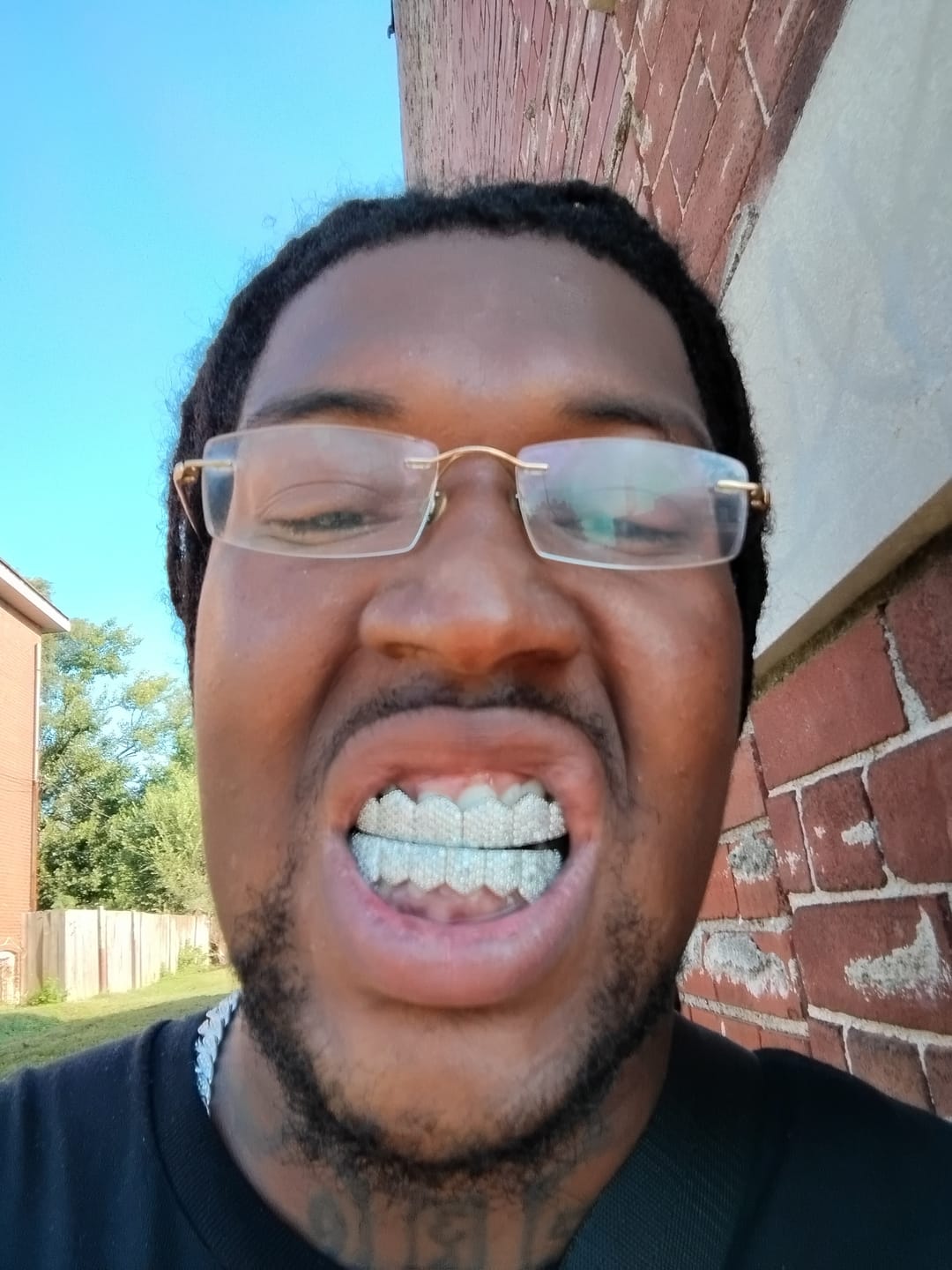Customer photo review of 8 Tooth Standard Iced Grillz - White Gold