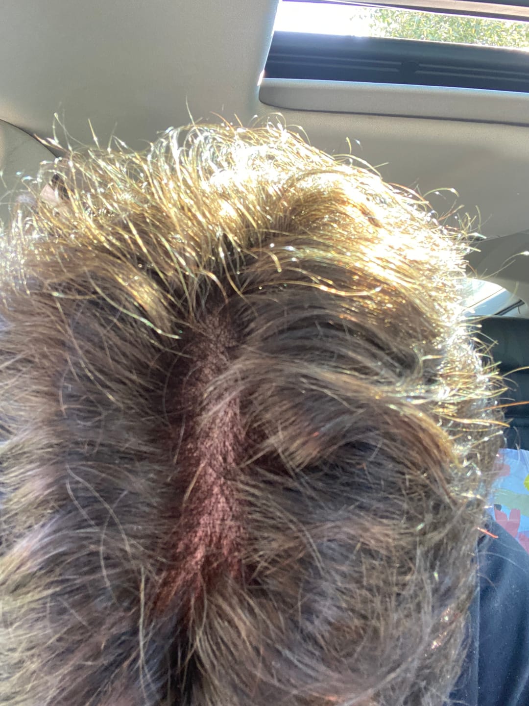Customer photo review of 70% Ultra-light Density Ace Full french lace Men hair system