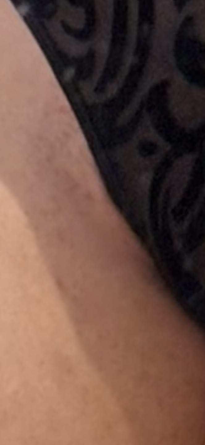 Customer photo review of Healing Intimate Oil