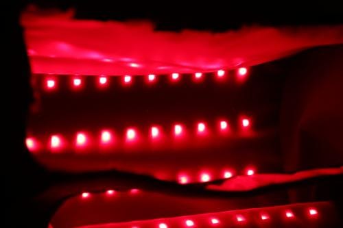 Customer photo review of LUMYHEALTH Red Light Therapy Boot for Feet