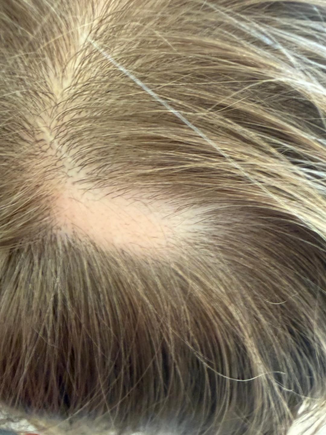 Customer photo review of Hair Growth Serum