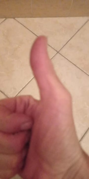 Customer photo review of Sérum para el contorno de ojos con aceite de ricino