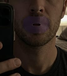 Customer photo review of Løna™ AirFlow Mouth Tape