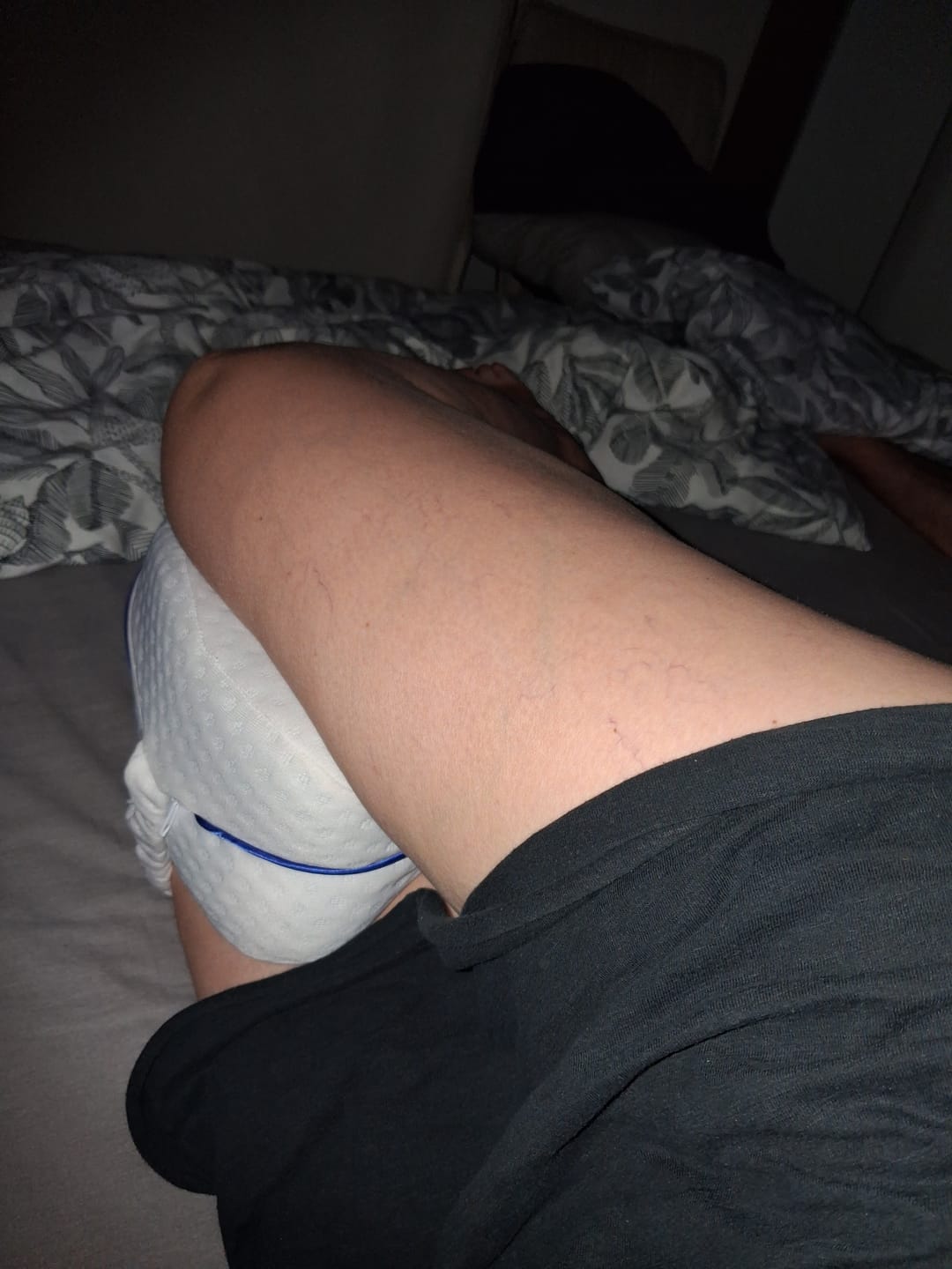 Customer photo review of Coussin Orthopédique Genoux Cellsius - Le secret d'un sommeil sans douleur