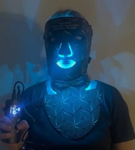 Customer photo review of LUMYHEALTH LED Red Light Therapy Face Mask(8 Colors)