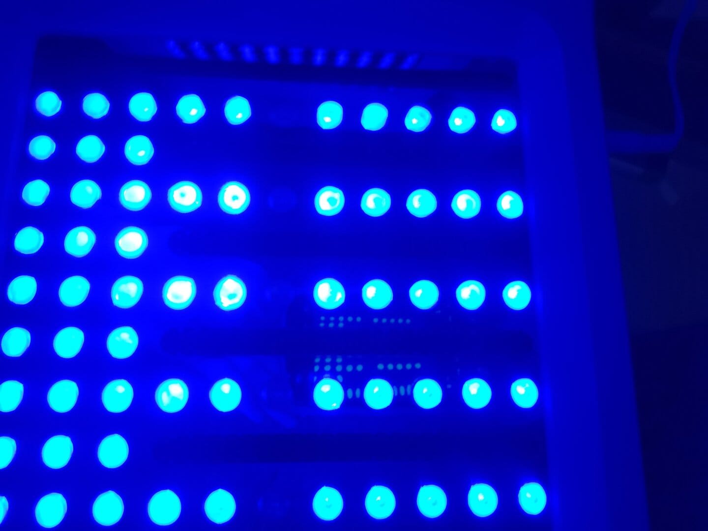 Customer photo review of Lumyhealth Salon LED Light Therapy Device