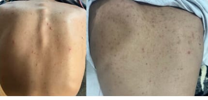 Customer photo review of Barra de Cúrcuma - Aclara Manchas y Devuelve la Luminosidad