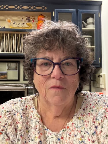 Reviewer's face wearing glasses, documenting progress after using the Seranova Micro Infusion System.