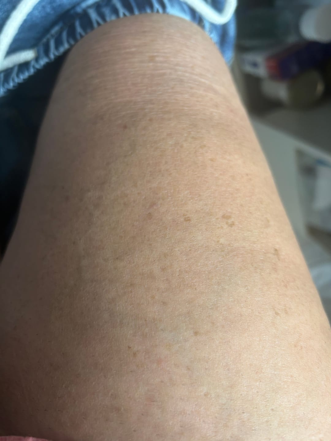 Customer photo review of Body Crème