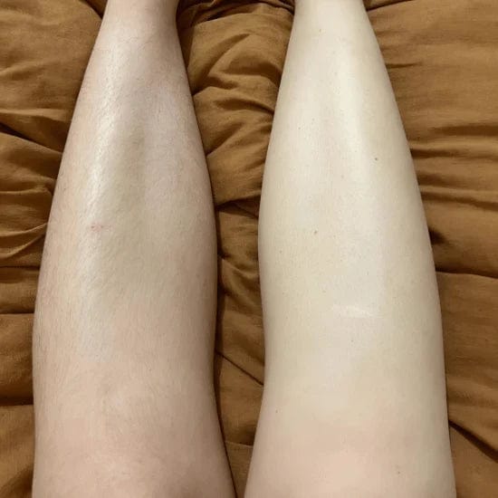 Customer photo review of Rasoio ROSALOVA