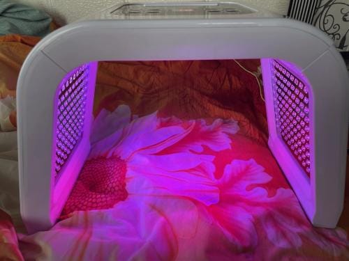 Customer photo review of LUMYHEALTH LED Light Therapy Machine