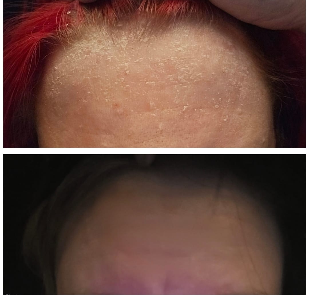 Customer photo review of Seb Natural Soothing Balm
