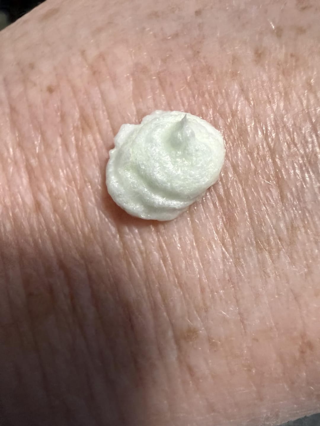 Customer photo review of Foam Cleanser