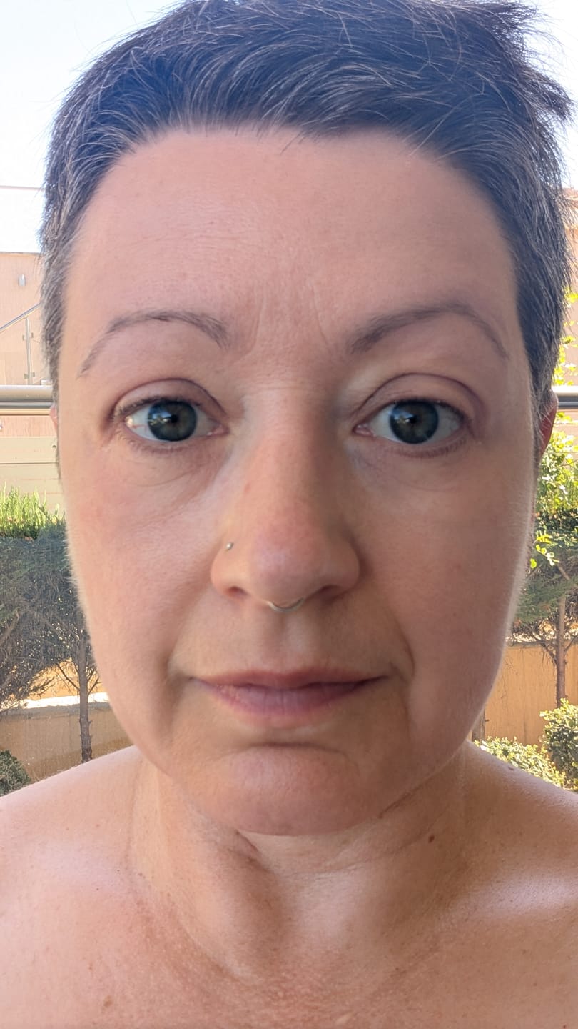 Customer photo review of Calm Skin-Relief Kit
