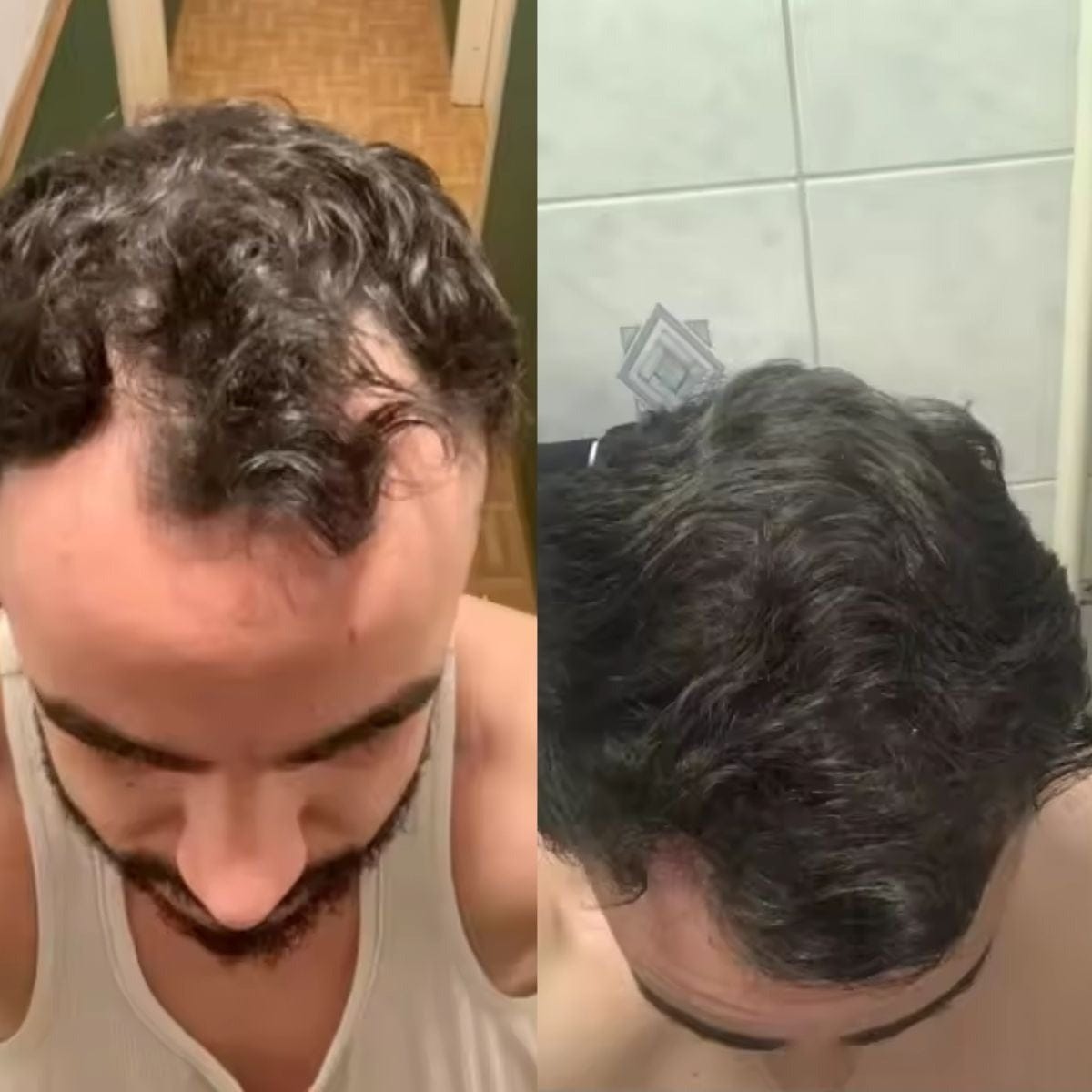 Customer photo review of Micro-Infusion System