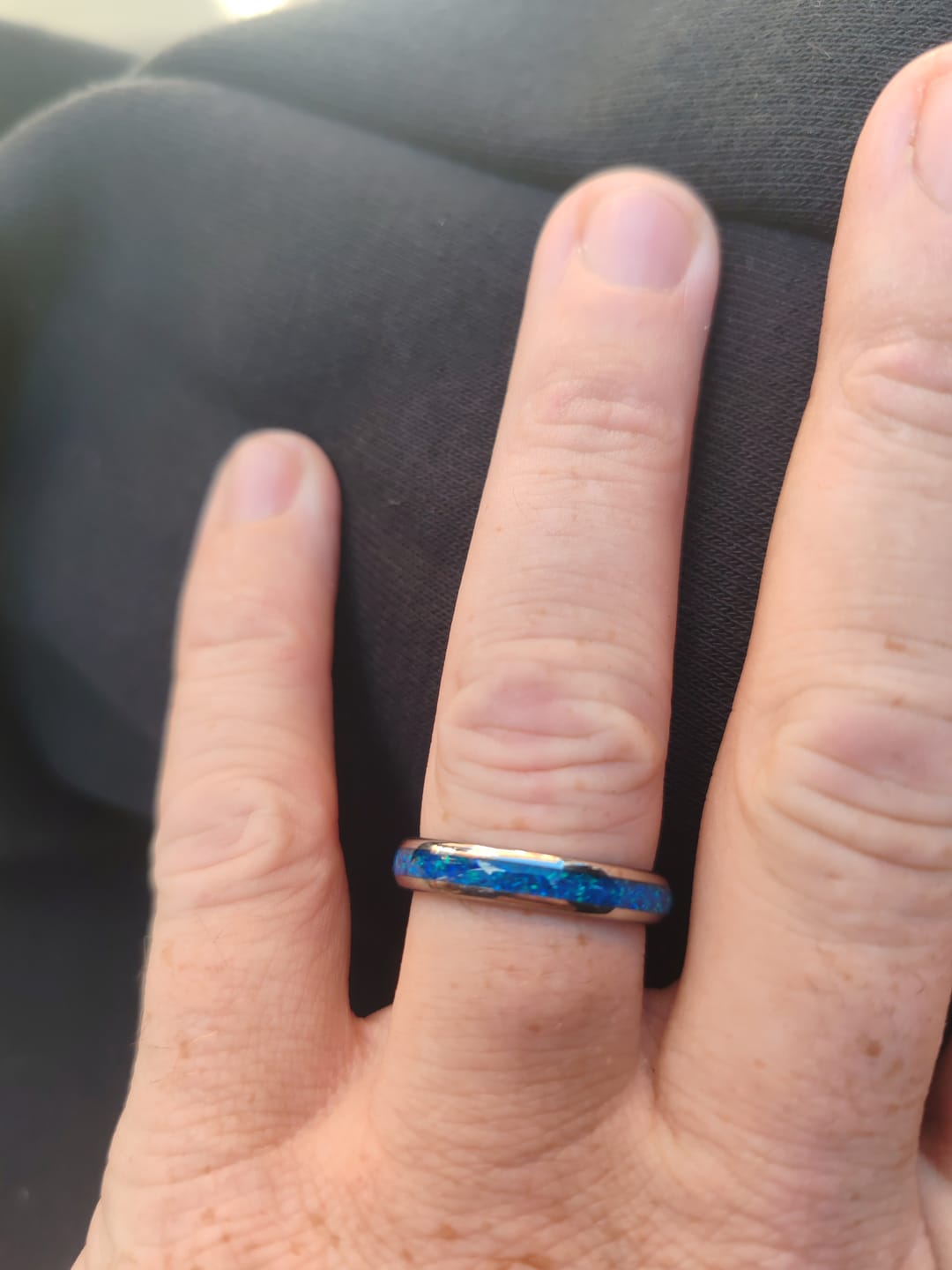 Customer photo review of The Blue Opal Wonder Ring Set