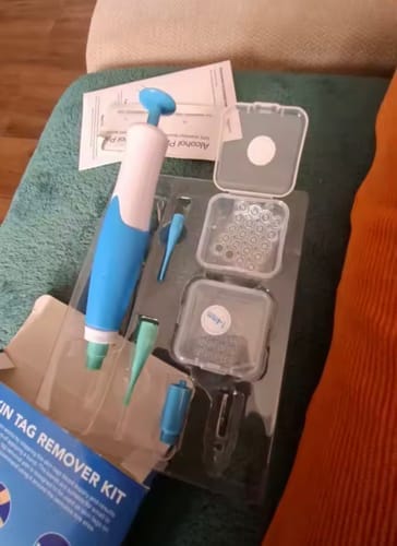 Customer photo review of Removedor Indoloro de Fibromas