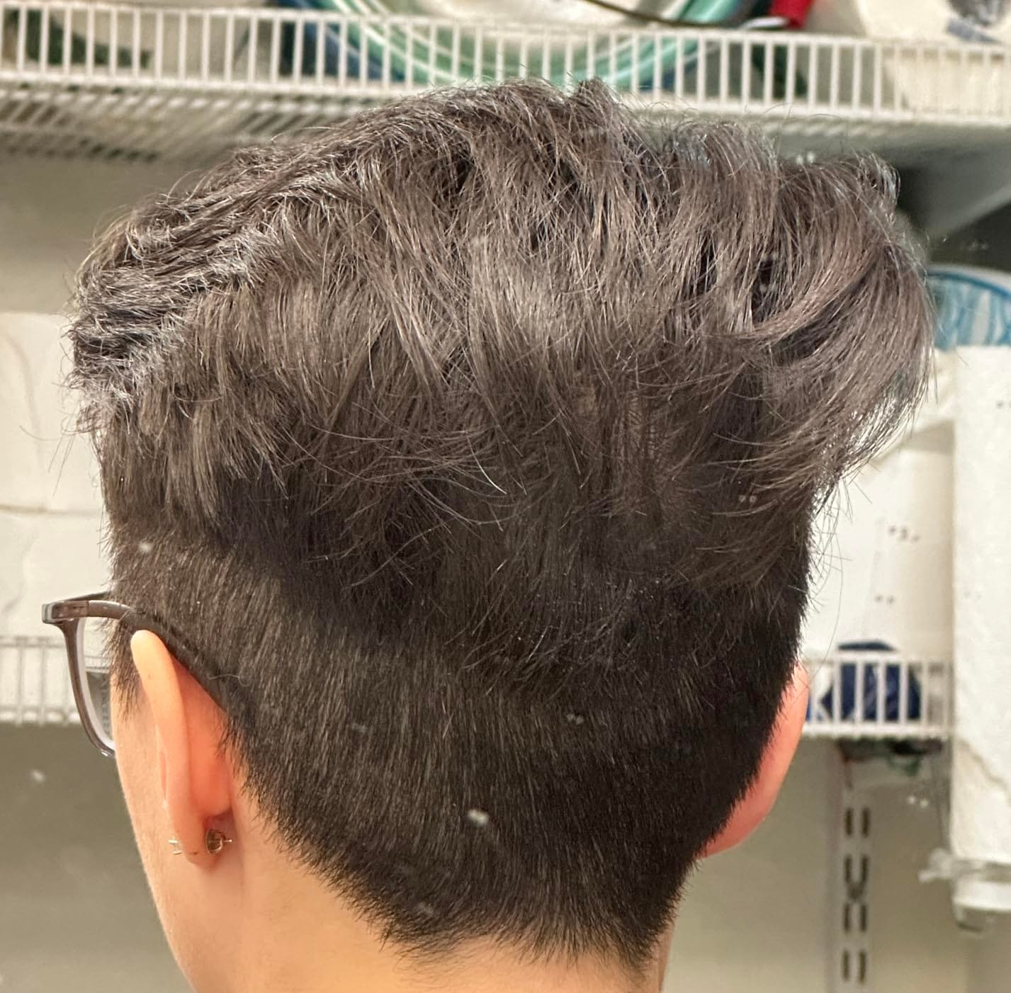 Customer photo review of RootRevive Scalp Serum